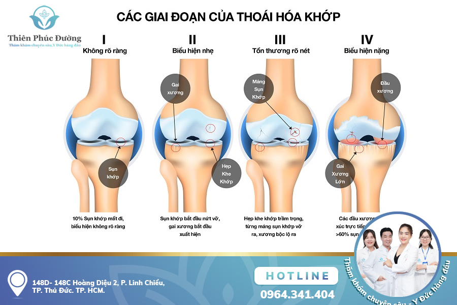 Thoái hóa khớp bệnh lý xương khớp thường gặp